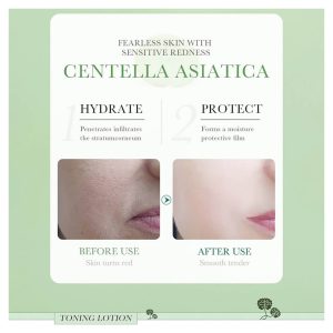 Bioaqua Centella Asiatica Soothing Dryness Repair Toner | Hydration, Oil Control, Anti-Acne, Moisturizing Skincare | 120ml (4.06fl oz)