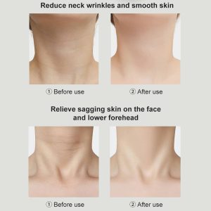 ES‑1081 3‑in‑1 Neck & Face Massager | 3 Color LED Therapy | Anti-Wrinkle | Thermal & Vibration | Face Sculpting Tool – White Massager