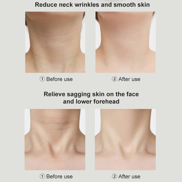 ES‑1081 3‑in‑1 Neck & Face Massager | 3 Color LED Therapy | Anti-Wrinkle | Thermal & Vibration | Face Sculpting Tool – White Massager - Image 15